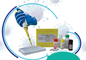 COVID-19 IgG ELISA KIT – کیت الایزا تشخیصی آنتی بادی علیه ویروس کووید-19