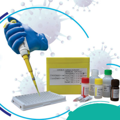 COVID-19 IgM ELISA KIT – کیت الایزای  تشخیصی ایمونوگلوبولین M علیه ویروس کووید-19