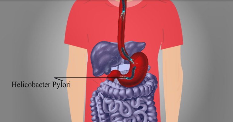 انیمیشن کیت الایزا اچ پیلوری محصول جدید شرکت دانش بنیان پادتن گستر ایثار