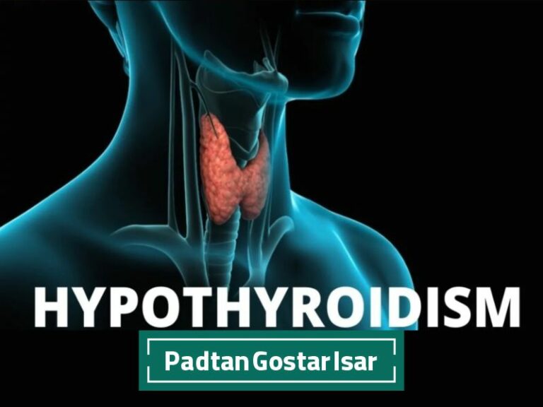 کم‌کاری تیروئید چیست و چه علائم و عوارضی دارد؟