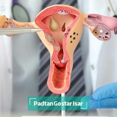 آزمایش پاپ اسمیر