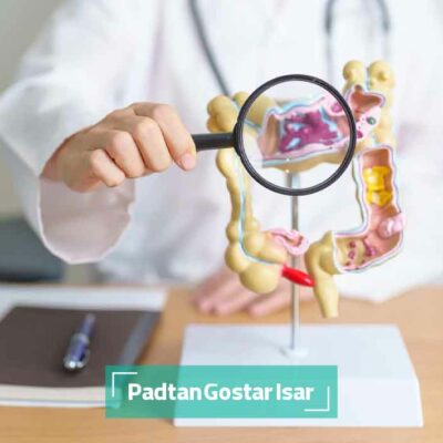 تست های غربالگری سرطان کولورکتال