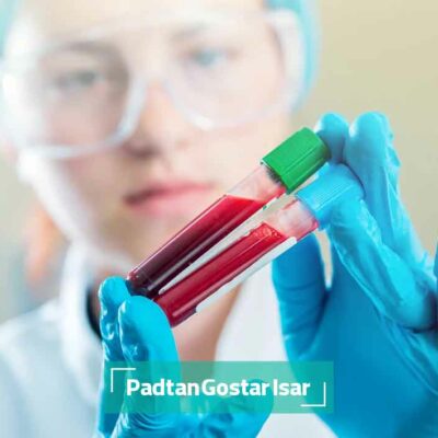 نحوه آزمایش لوسمی